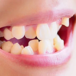 Best Private Dentist Near me