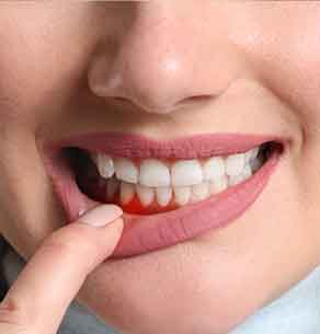 gum disease treatment