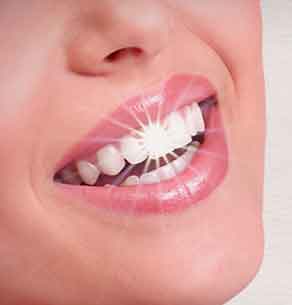 teeth whitening in Aldershot