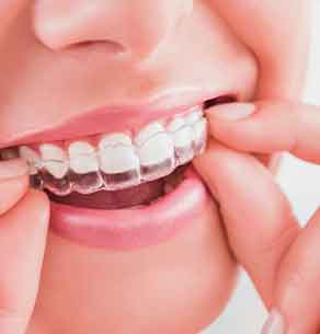 tooth replacement service from Northlane