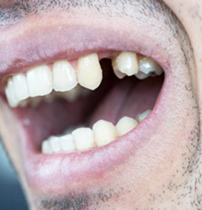 Aldershot Health Centre Dentist