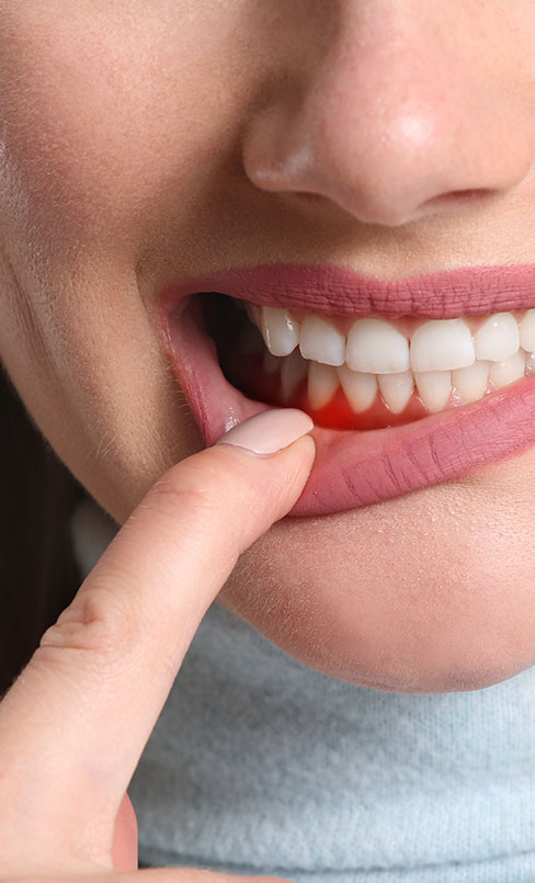 Gum Infection Treatment Near Me